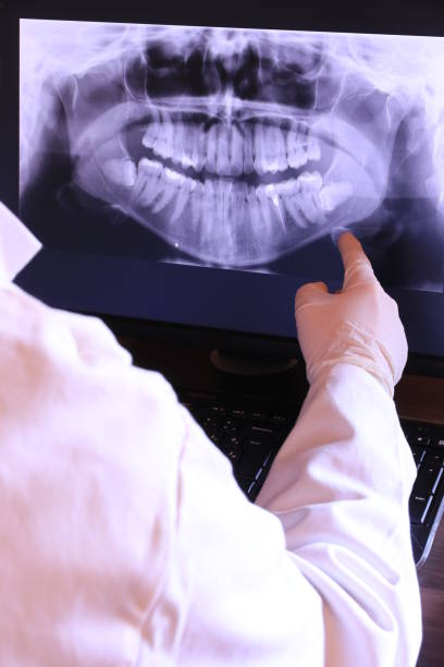 Best Emergency Dental Care for Broken or Chipped Teeth in Ridge Manor, FL