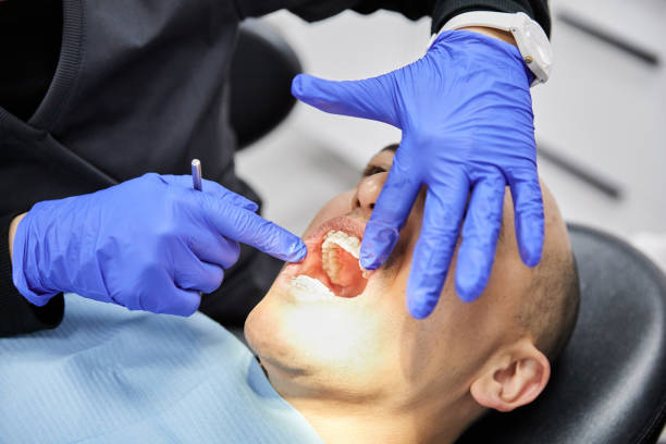 Best Emergency Treatment for Dental Infections or Abscesses in Ridge Manor, FL