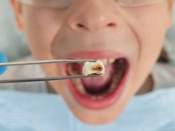 Best Cosmetic Emergency Dentistry in Ridge Manor, FL